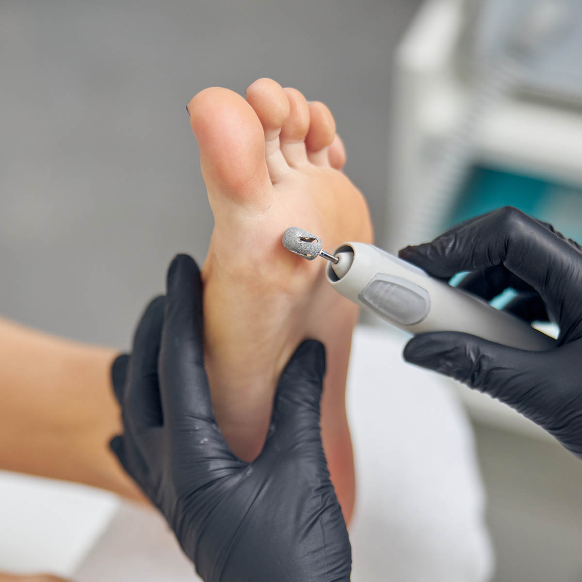 Perfekcyjny pedicure – jakim frezem opracować pięty?